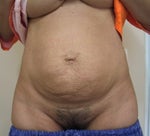 before the operation